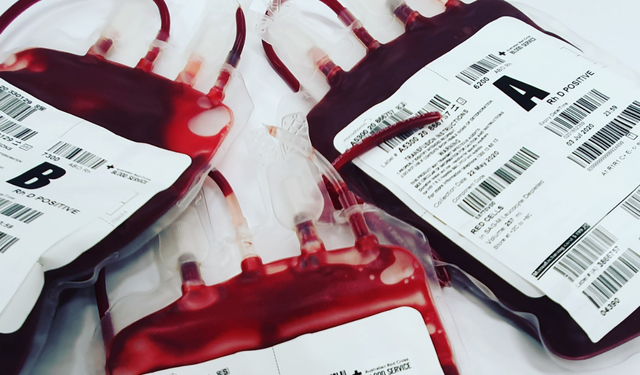 Hematoloji nedir, hangi hastalıklara bakar?