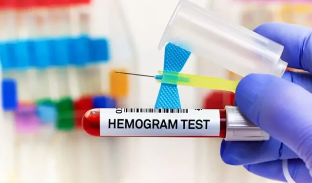 Hemogram HTC nedir? Hemogram HTC kaç olmalı?