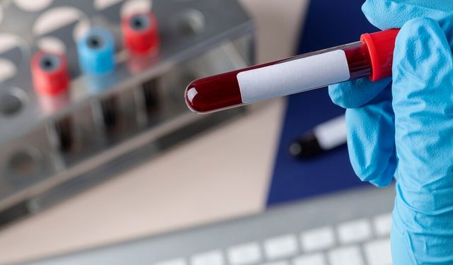 Fibrinojen yüksekliği nedir, neden artar ve nasıl düşürülür?