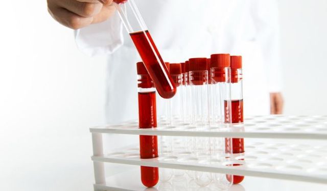 Hemogram NEU nedir? Hemogram NEU yüksekliği nedir?