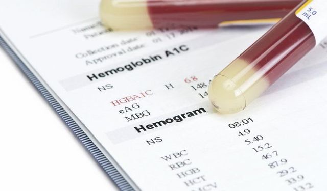 Hemogram RBC yüksekliği nedir? Hemogram RBC değeri kaç olmalı?