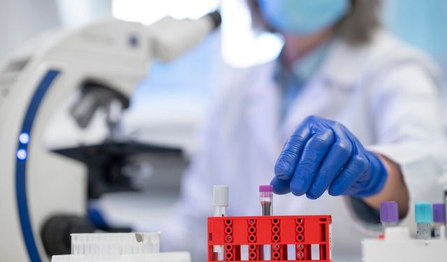 MCV düşüklüğü ve yüksekliği nedir? Belirtileri, nedenleri ve tedavisi nelerdir? MVC kan testi ne zaman yapılır?