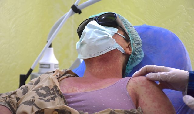 Krem diye aldılar hastanelik oldular