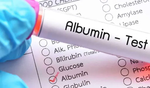 Albümin serum plazma nedir? Albümin serum plazma yüksekliği neden olur?