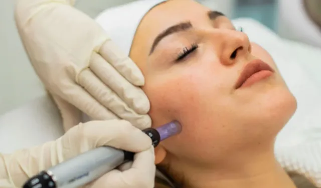 Dermapen nedir? Dermapen uygulaması ne işe yarar? Faydaları ve sonuçları