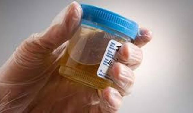 İdrarda protein kaçağı nedir? Belirtileri, nedenleri ve tedavi yöntemleri nelerdir?