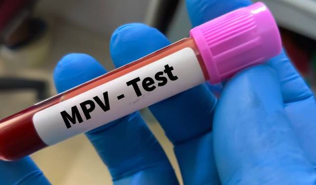 Hemogram MPV yüksekliği nedir? MPV testi neden yapılır? MPV değeri kaç olmalıdır?