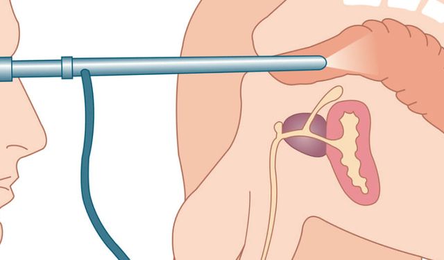 Rektoskopi nedir ve nasıl yapılır?