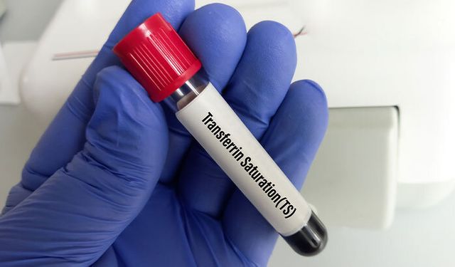 Transferrin satürasyonu nedir? Transferrin satürasyonu düşüklüğü ve yüksekliği ne anlama gelir?