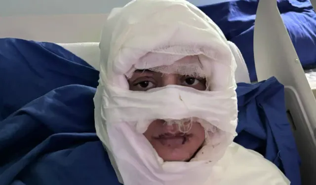 Kadıköy’de genç kadını ateşe verdiği iddia edilen saldırgan tutuklandı