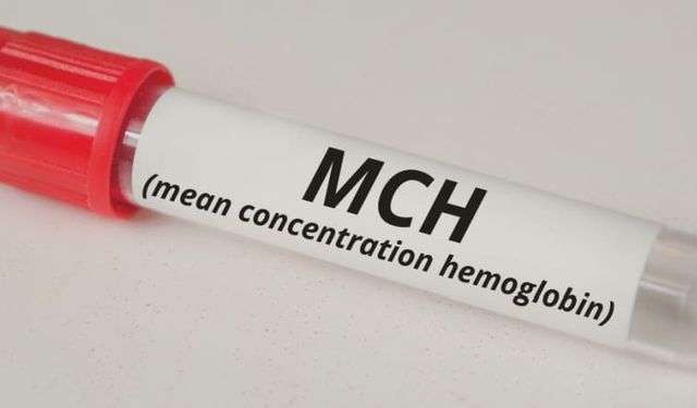 Hemogram MCH nedir? Hemogram MCH ne işe yarar, MCH değeri kaç olmalıdır?