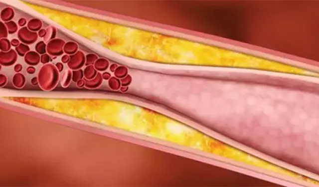 Trigliserid düşüklüğü nedir, neden olur, belirtileri ve tedavi yöntemleri nelerdir?