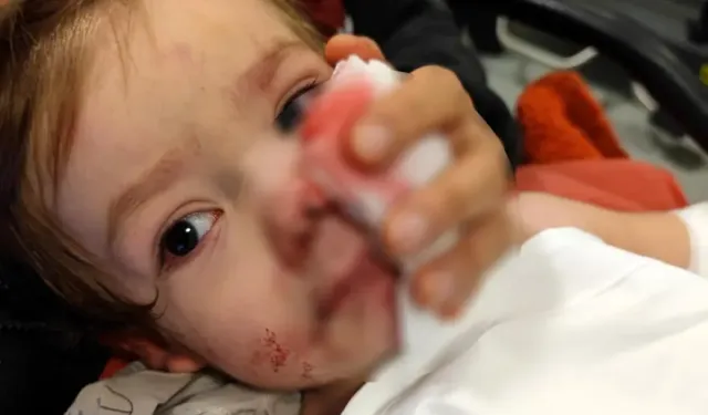 Ankara’da pitbull saldırısına uğrayan minik Efe ile ilgili yeni gelişme