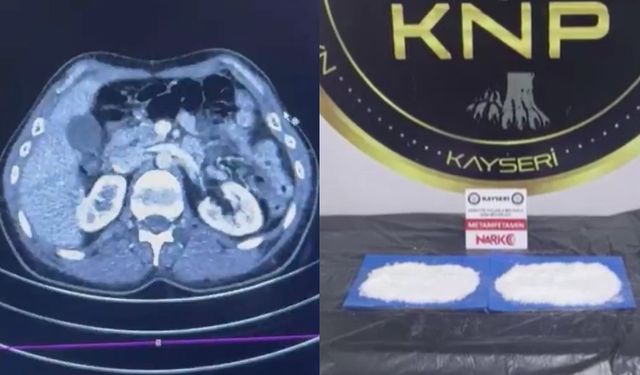 Kayseri'de film gibi operasyon: Midesinde uyuşturucu ile Türkiye'ye girdi!