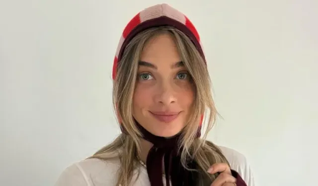 Müge Boz'un 10 senedir uğraştığı sedef hastalığı nedir? Sedef hastalığı bulaşıcı mıdır?