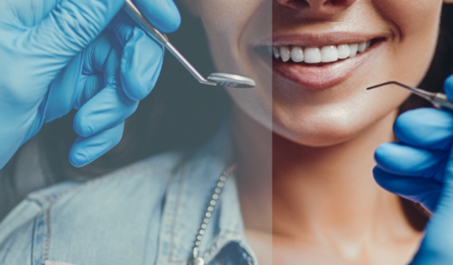 Diş protez gerçeği: Kalite ve süreç tartışması