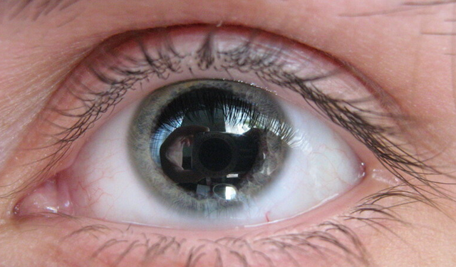 Midriyasiz nedir, zararları nelerdir? Ciddi bir hastalık mı?