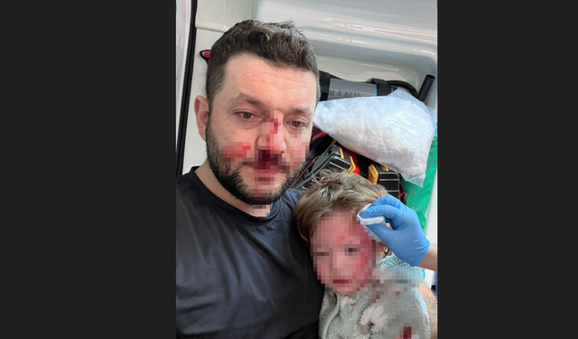 Baba ve 14 aylık kızı darbedildi! Dehşet sonrası teşekkür mesajı!