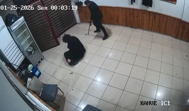 Boşanma aşamasındaki eşi tarafından av tüfeğiyle vurulan kadın bir bacağını kaybetti: Dehşeti anlattı