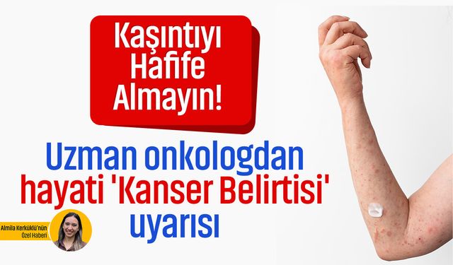 Kaşıntıyı hafife almayın! Uzman onkologdan hayati 'Kanser Belirtisi' uyarısı