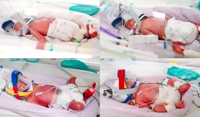 15 milyonda bir görülen mucize Avustralya'da gerçekleşti! Tek yumurta dördüzleri dünyaya geldi