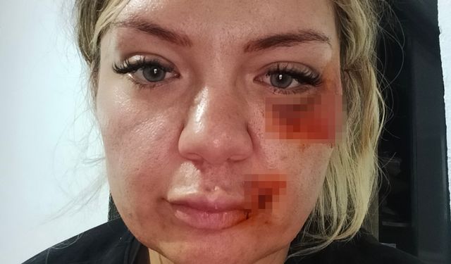"Bugün büyük gün" diyerek aradı dehşeti yaşattı! Yüzünden bıçaklandı