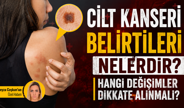 Cilt kanseri belirtileri nelerdir? Hangi değişimler dikkate alınmalı?