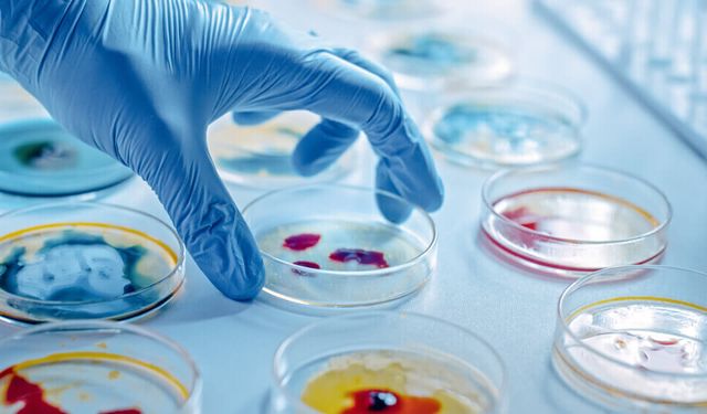Etiketteki probiyotik ibaresine aman dikkat: Uzmandan tüketiciye üç uyarı