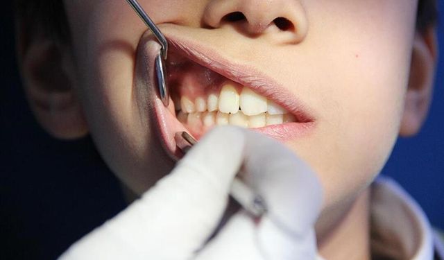 Dişini çektiren çocuk hayatını kaybetti!