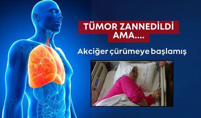 66 yaşındaki kadının akciğerinden ne çıktığına inanamayacaksınız!