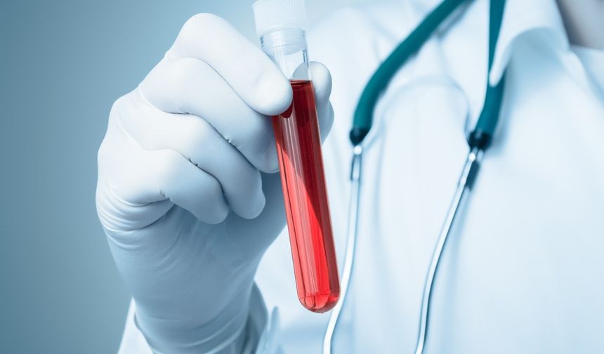 RDW-CV nedir? Kan tahlilinde RDW-CV düşüklüğü ve yüksekliği ne anlama gelir?