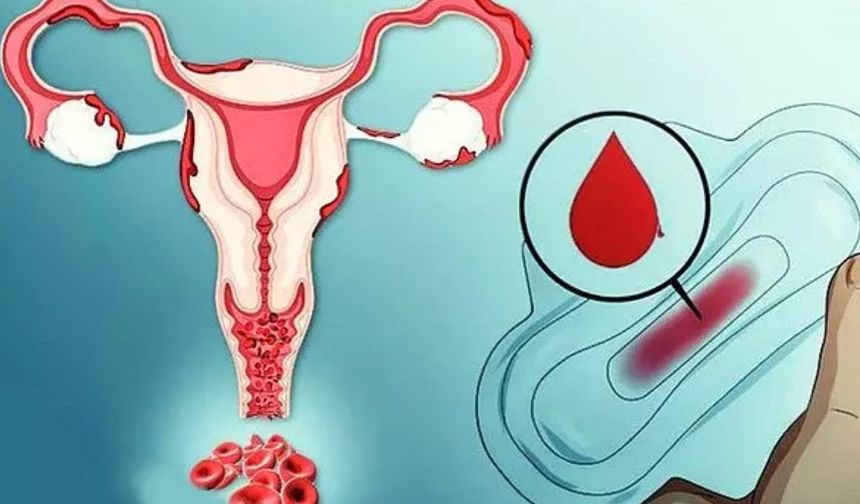 Yerleşme kanaması nedir, nasıl olur, ne zaman olur, kaç gün sürer?