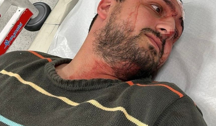 Dehşet veren olay: İzmit'te otizmli gence odunla şiddet uygulayan fırıncı tutuklandı!