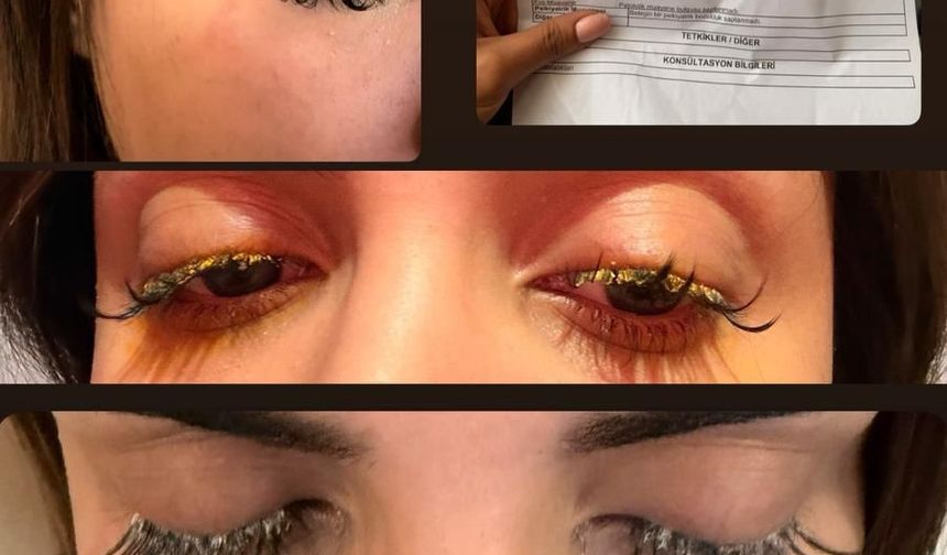 Güzellik salonunda kirpik faciası: 'Gözlerim göremez hale geldi'