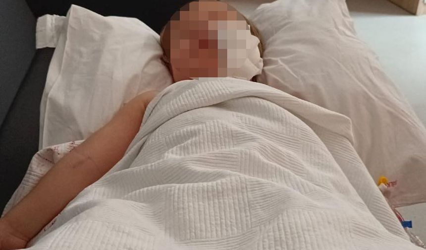 Pitbull saldırısına uğrayan minik Efe'den üzen haber: Baba konuştu!