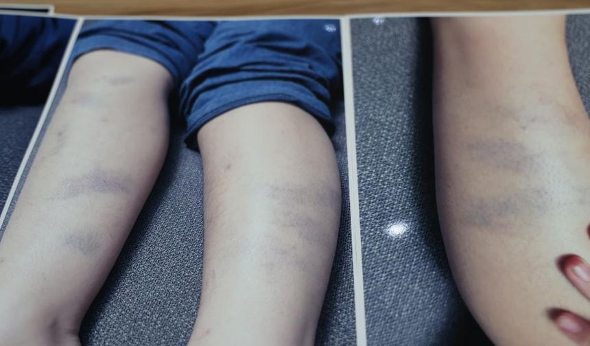 Diyarbakır’da özel okulda darp iddiası: Okul suçlamaları reddetti!