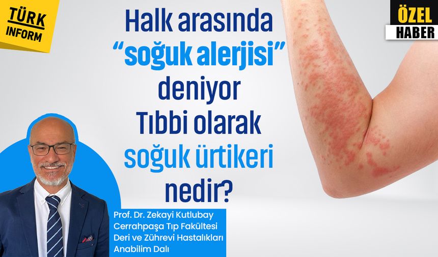 Halk arasında "soğuk alerjisi" deniyor: Tıbbi olarak soğuk ürtikeri nedir?