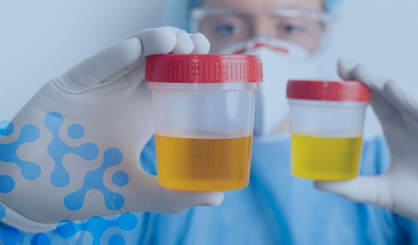 Kırmızı, kahverengi ve turuncu idrar neyin belirtisi? Hangi durumlarda doktora gidilmeli?