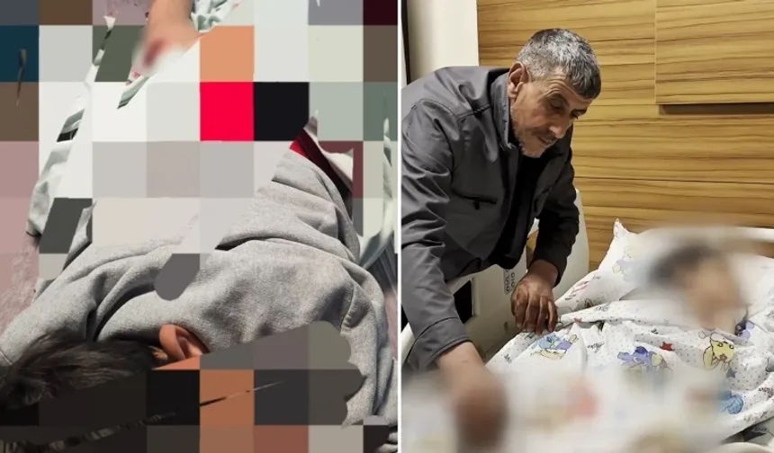 Van'da sokak köpeği dehşeti: 11 yaşındaki çocuk parçalamaktan son anda kurtuldu!