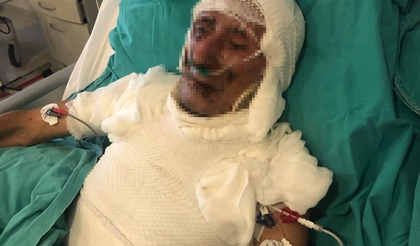 Kardeşini ahırda yakan kişinin cezası belirlendi