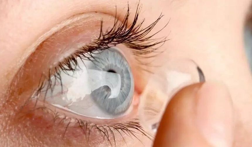 Kontakt lens kullananlar dikkat! Gözde bu belirtiler varsa lens hemen çıkarılmalı mı?