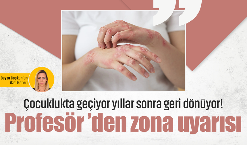Çocuklukta geçiyor yıllar sonra geri dönüyor! Profesör ’den zona uyarısı