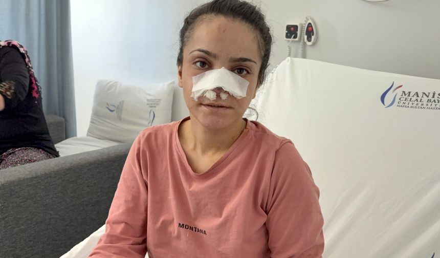 Burnu koparılan kadın o anları anlattı: "Bir anda boynuma sarılıp ısırdı"