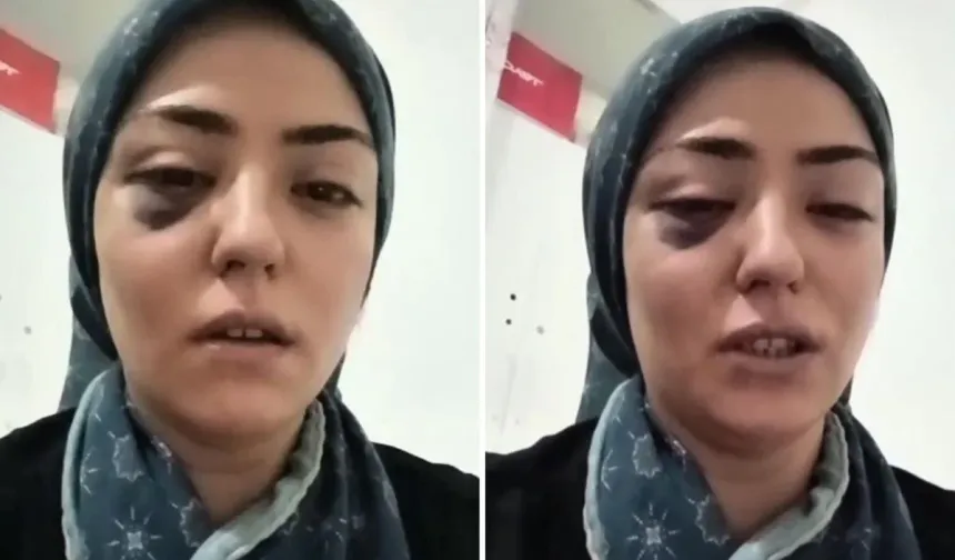 Gaziantep’te bir annenin "Yaşıyorken adalet istiyorum" diyen feryadı sosyal medyada gündem oldu!