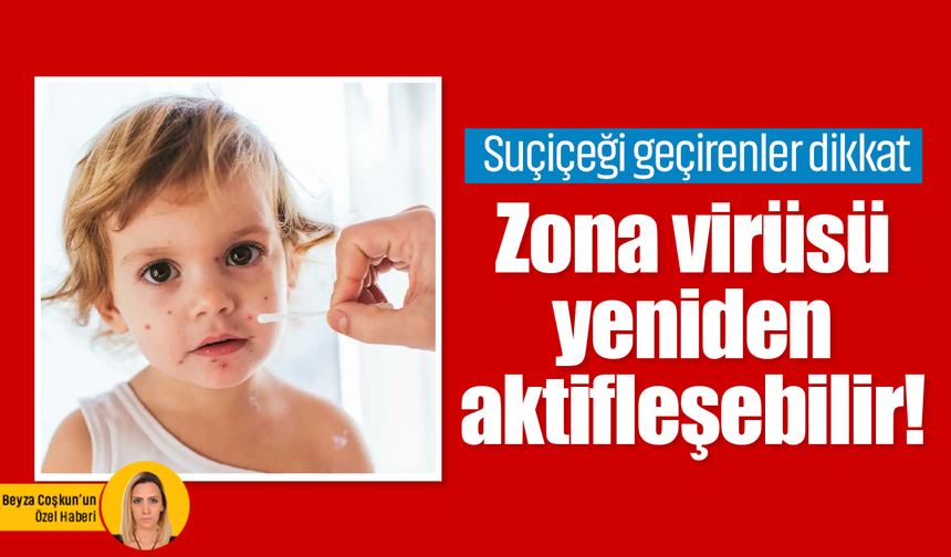 Suçiçeği geçirenler dikkat: Zona virüsü yeniden aktifleşebilir!
