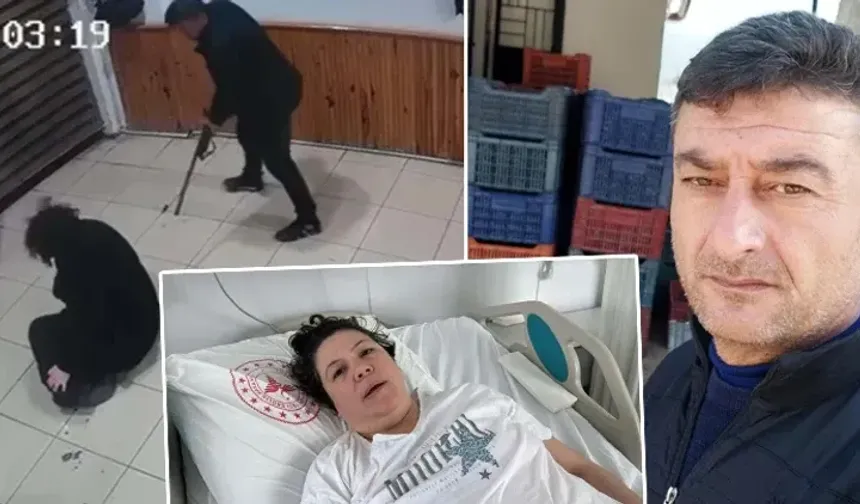 Eşini vurdu, iki bacağı ampute edildi: Savunması şaşırttı