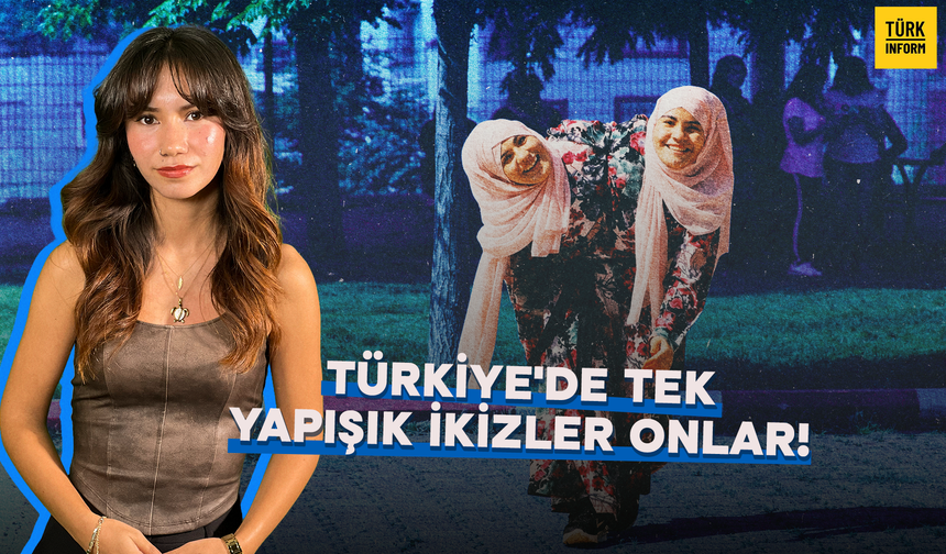 Siyam İkizleri Sema Ve Ayşe’nin Şaşırtan Hayatı: İki Farklı Beyin, Tek Beden
