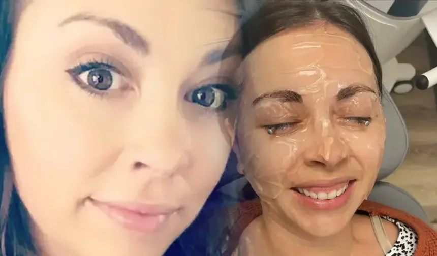 20 yıl makyajla uyudu: Göz kapağı göz küresine yapıştı
