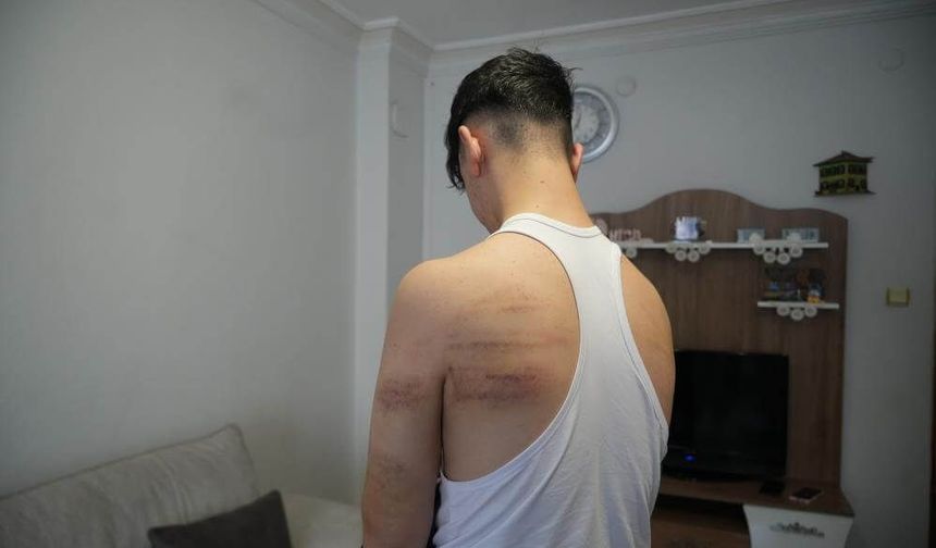 15 yaşındaki çırağa demir sopalı dehşet! Önce dövdü, sonra temizlik yaptırdı