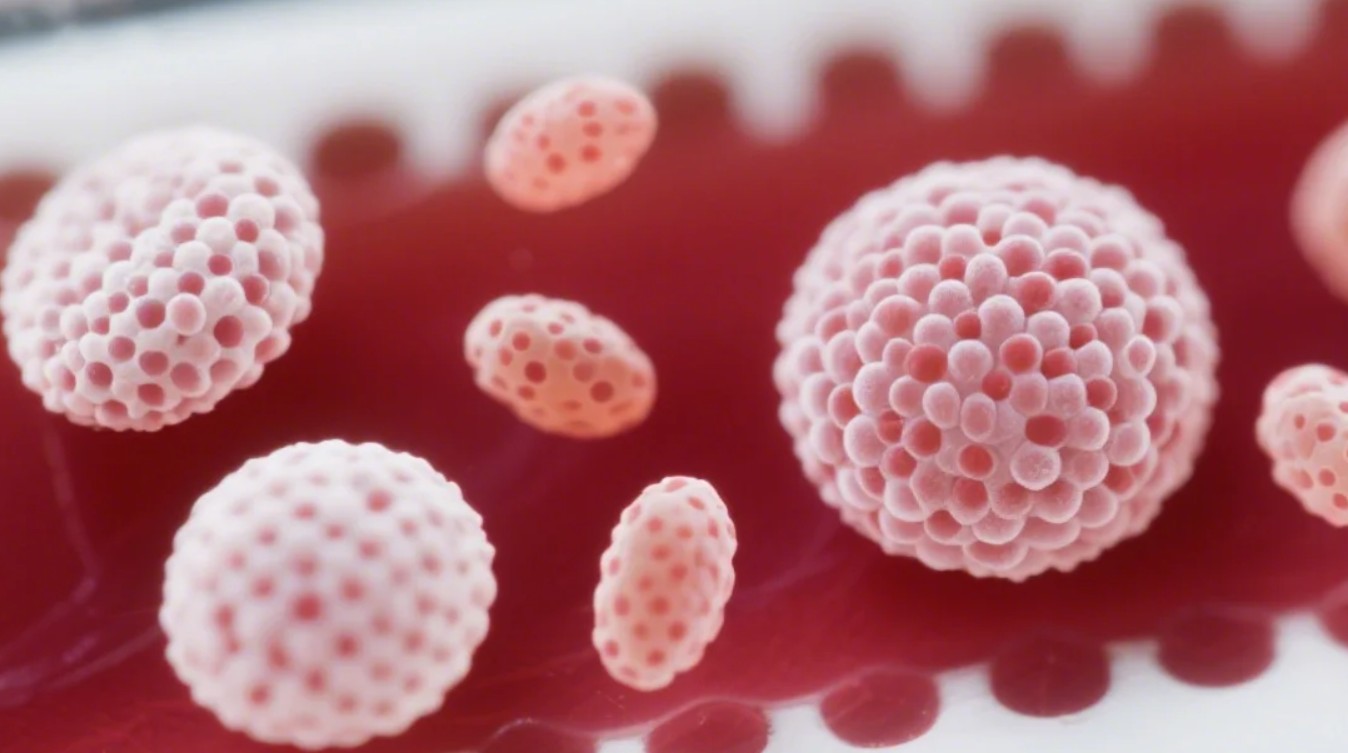 Lökosit Pozitif Nedir